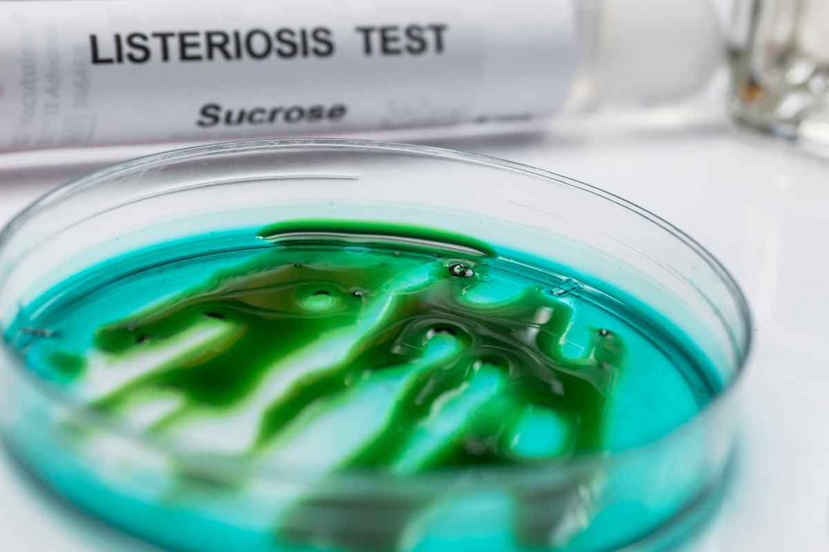listeriosi in laboratorio